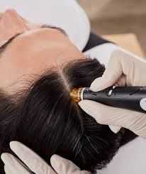 Person receiving a scalp treatment with a specialized device held by gloved hands.