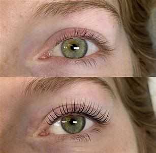 Before and after comparison of an eye showing the effects of an eyelash treatment.