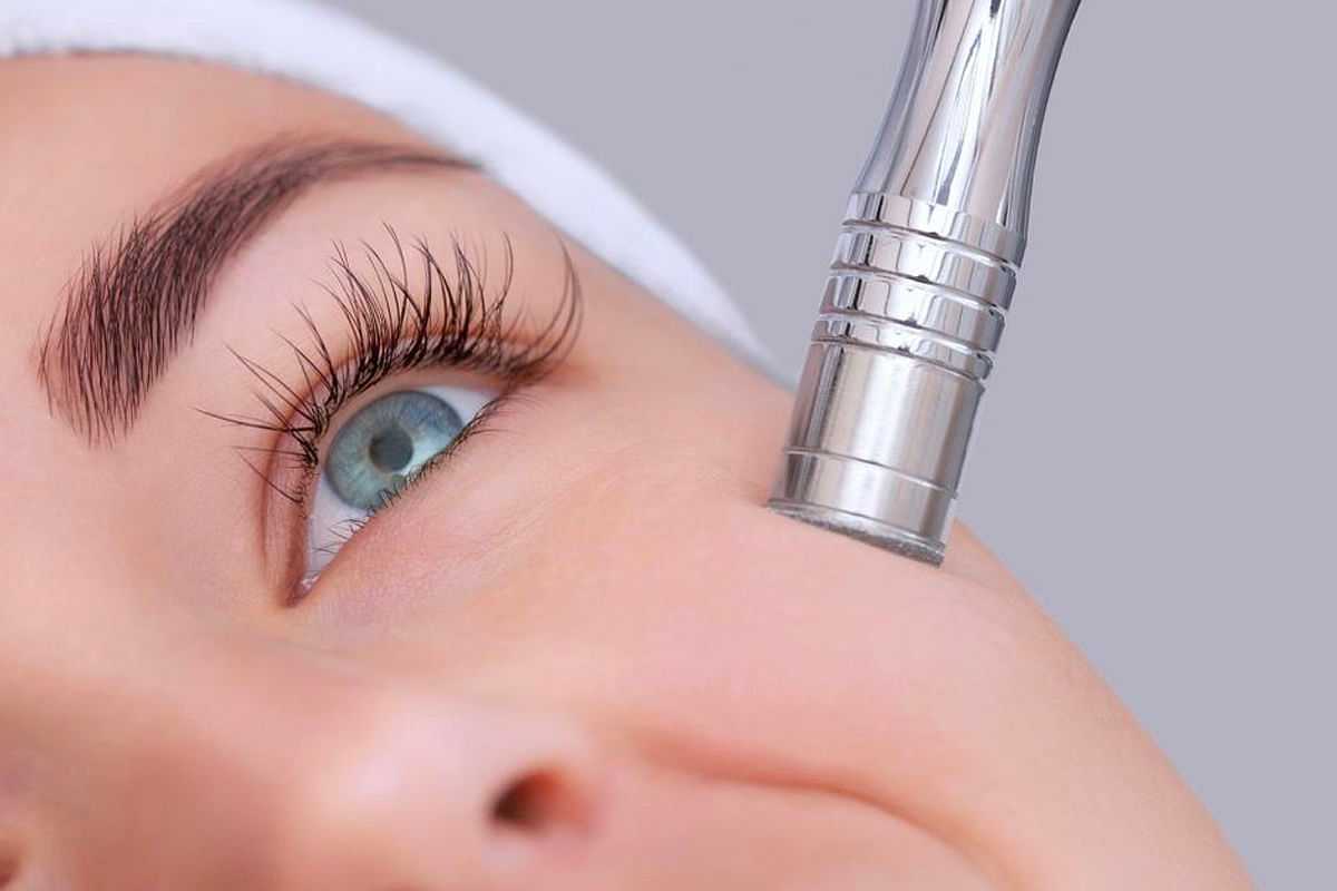 Close-up of a person's face undergoing a microdermabrasion skin treatment with a handheld device.