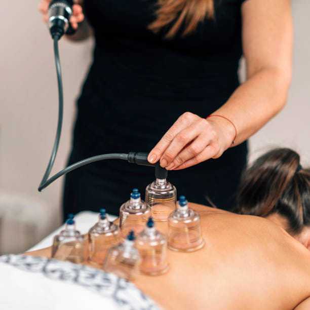 Cupping therapy session with multiple cups applied to a person's back.