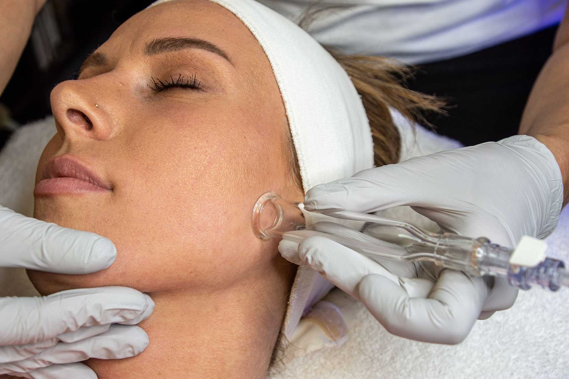 Woman receiving facial treatment with a suction device at a spa.